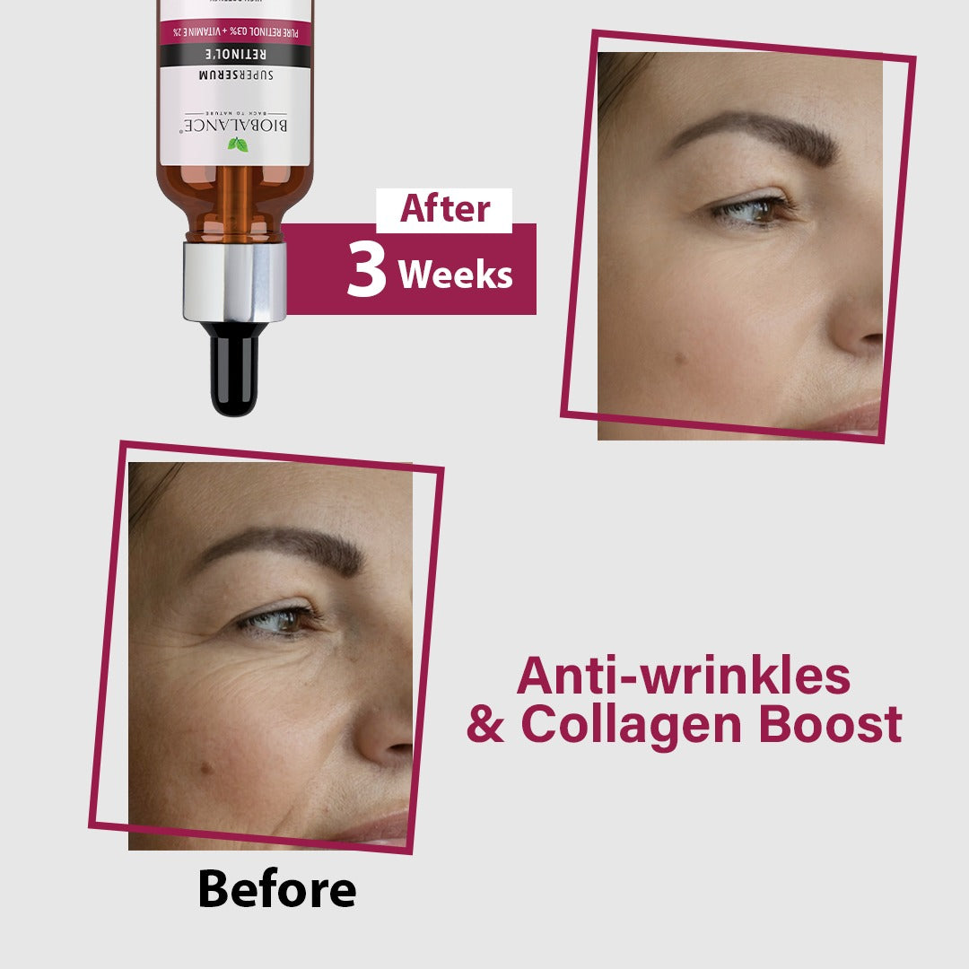 Serum Anti Aging