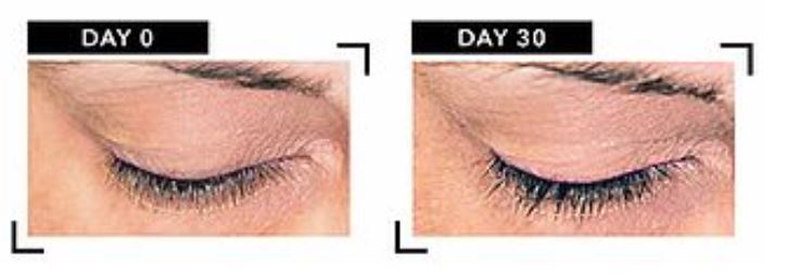 eyelash growth serum
