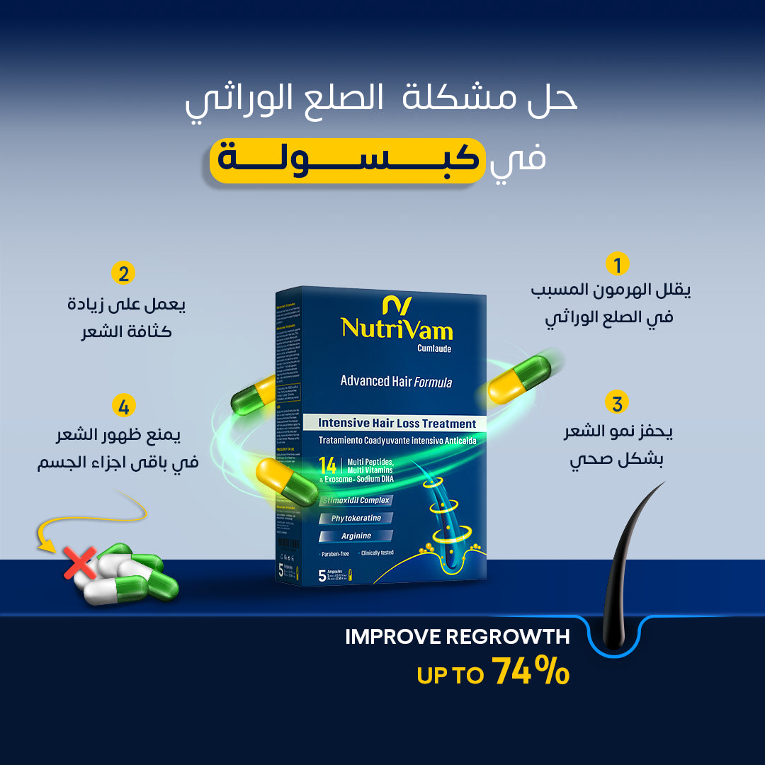 genetic baldness treatment