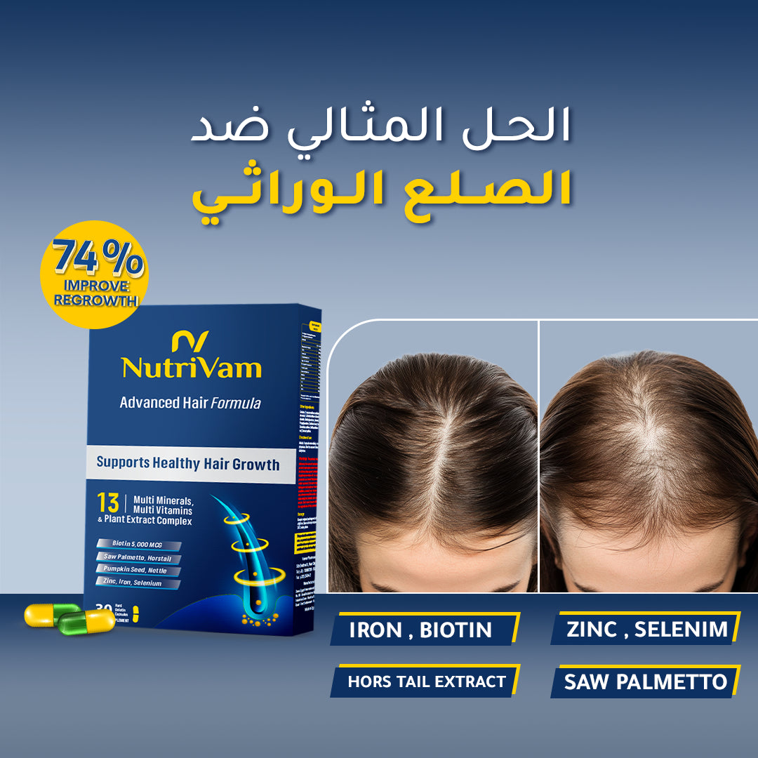 genetic baldness treatment