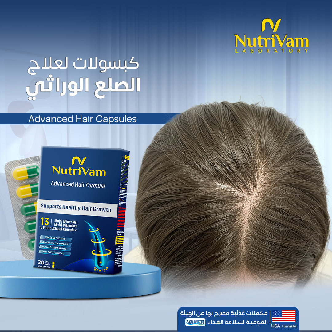 genetic baldness treatment